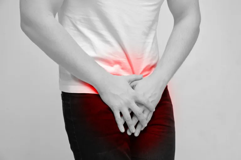 Diagram showing prostate inflammation and related symptoms